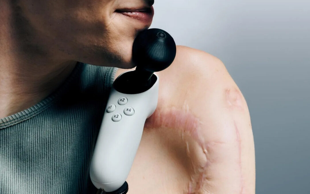 Xbox presenta il nuovo Adaptive Joystick